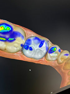 Praxislabor: CEREC – Zahnersatz an einem Tag